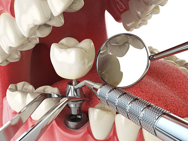 Best Emergency Care for Gum Disease in Oakland, MO